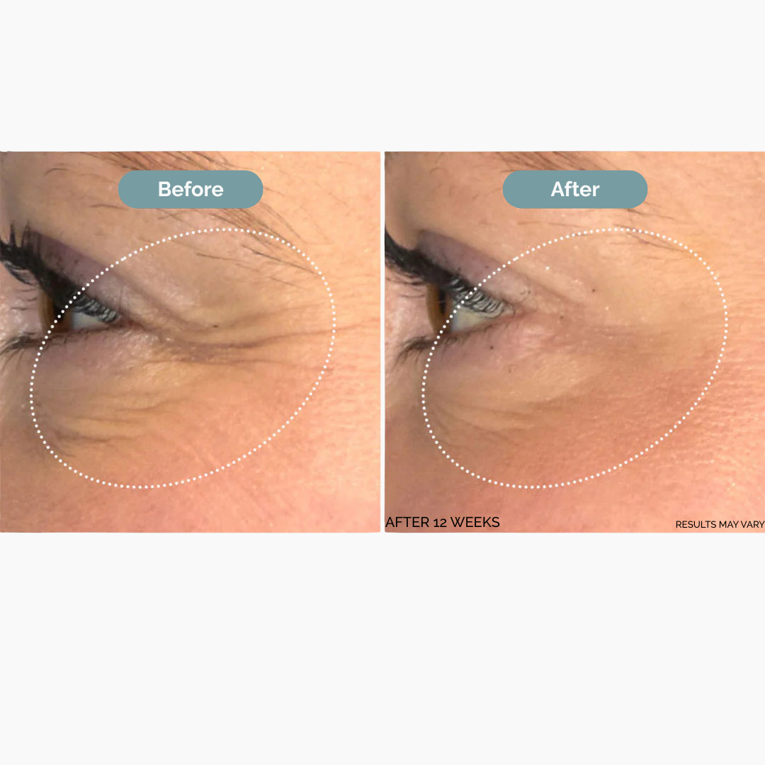 SkinLift™Growth Factor Serum